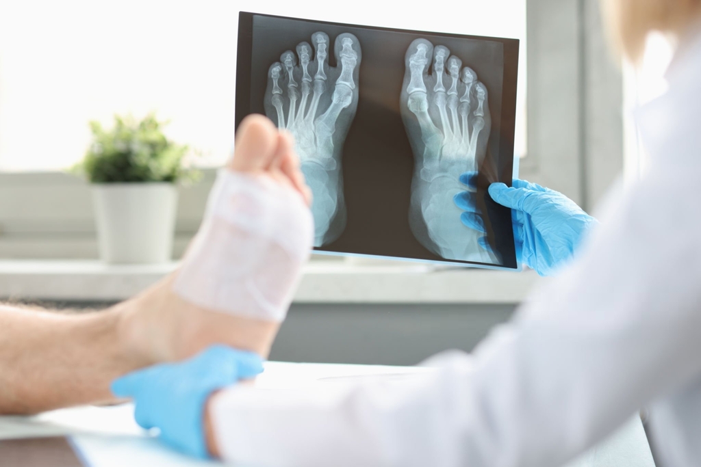 الأشعة العادية الديجيتال بالمنزل Digital X-Ray بأجهزة حديثة من Ultrascan